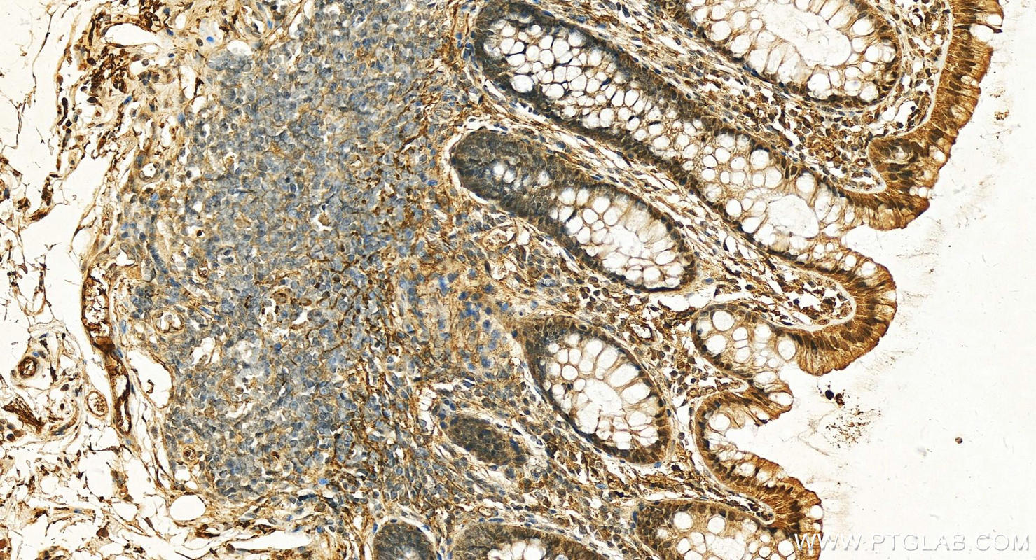IHC staining of human colon using 20773-1-AP