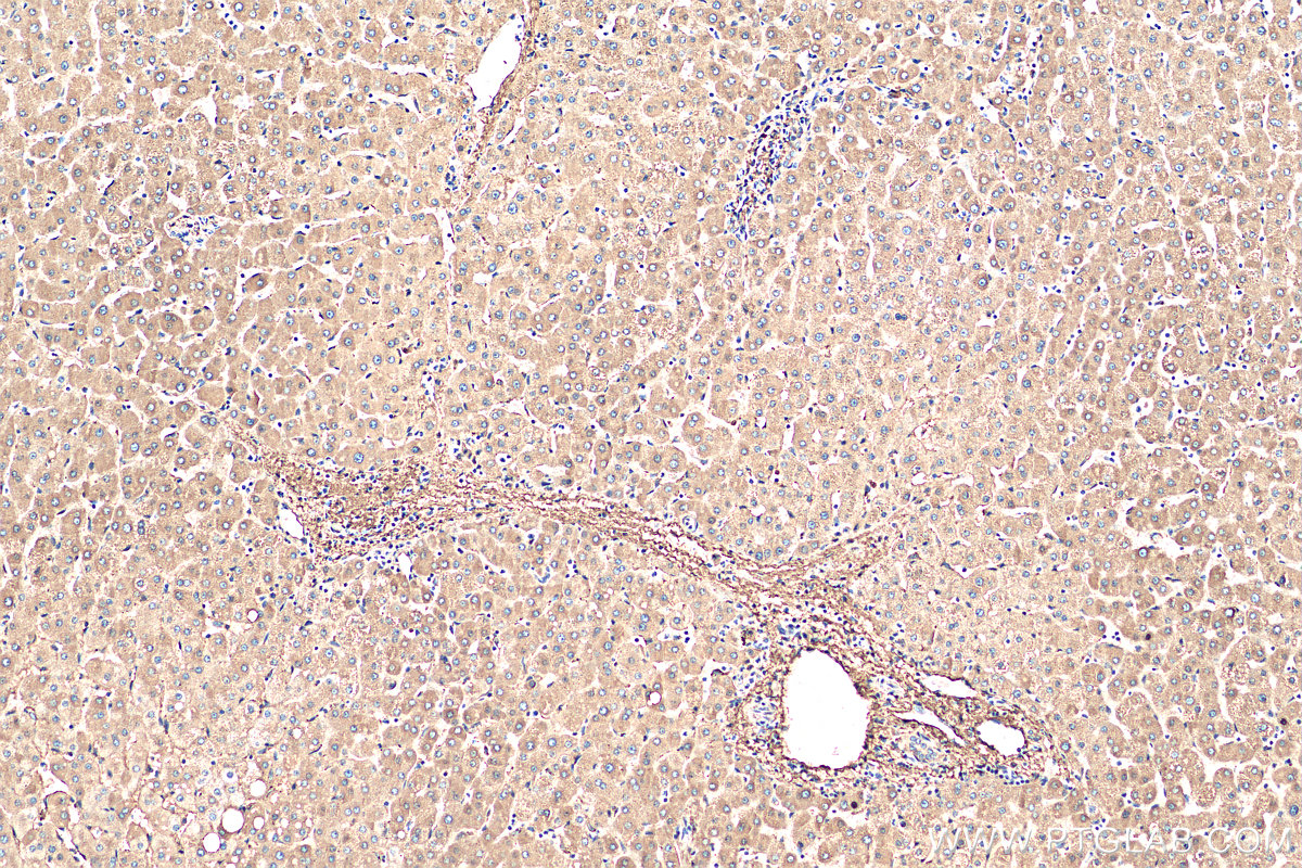 IHC staining of human liver using 20773-1-AP