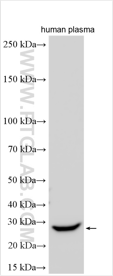 WB analysis using 20773-1-AP WB analysis using 20773-1-AP