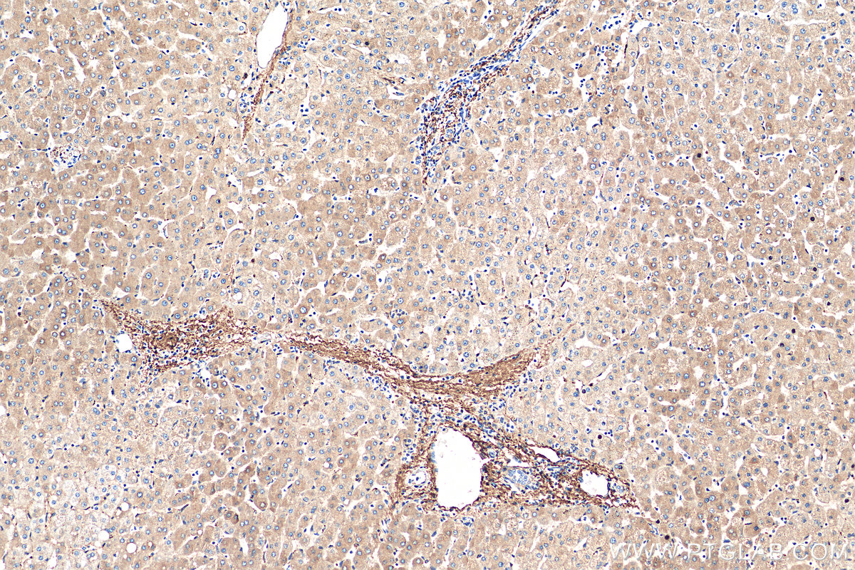 IHC staining of human liver using 66084-1-Ig