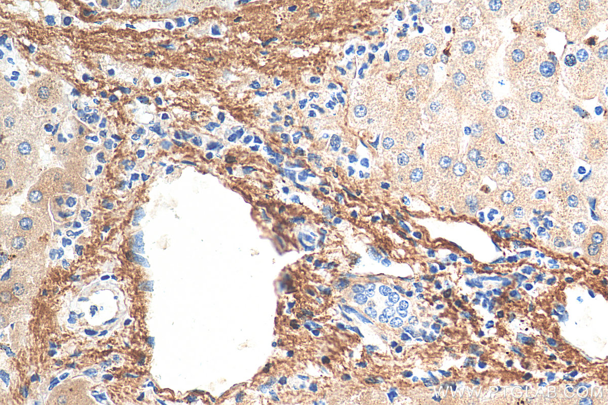 IHC staining of human liver using 66084-1-Ig