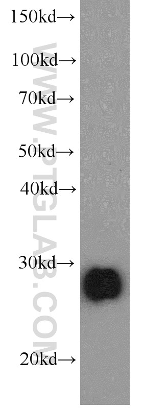 Serum amyloid P component Monoclonal antibody