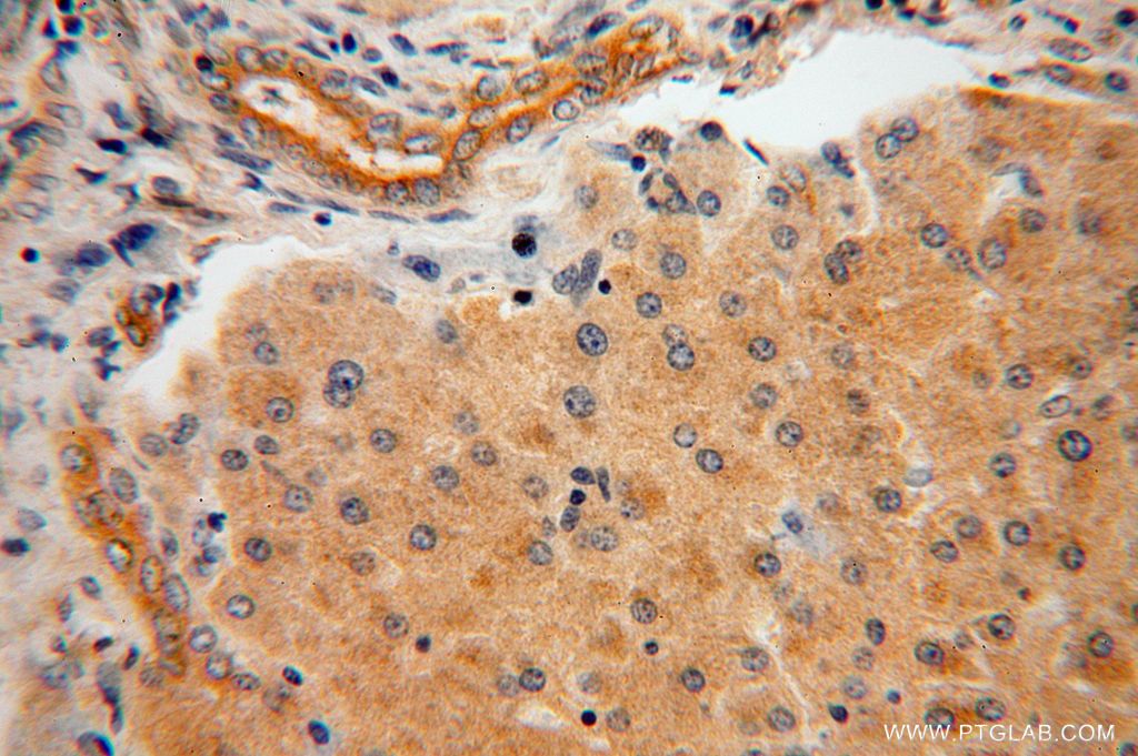 IHC staining of human liver using 14758-1-AP