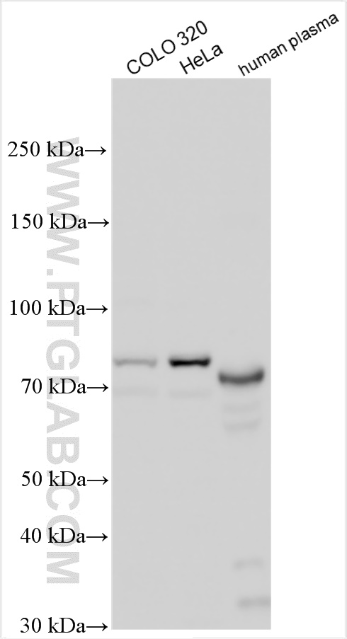 WB analysis using 14758-1-AP