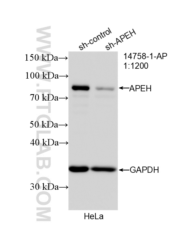 WB analysis of HeLa using 14758-1-AP