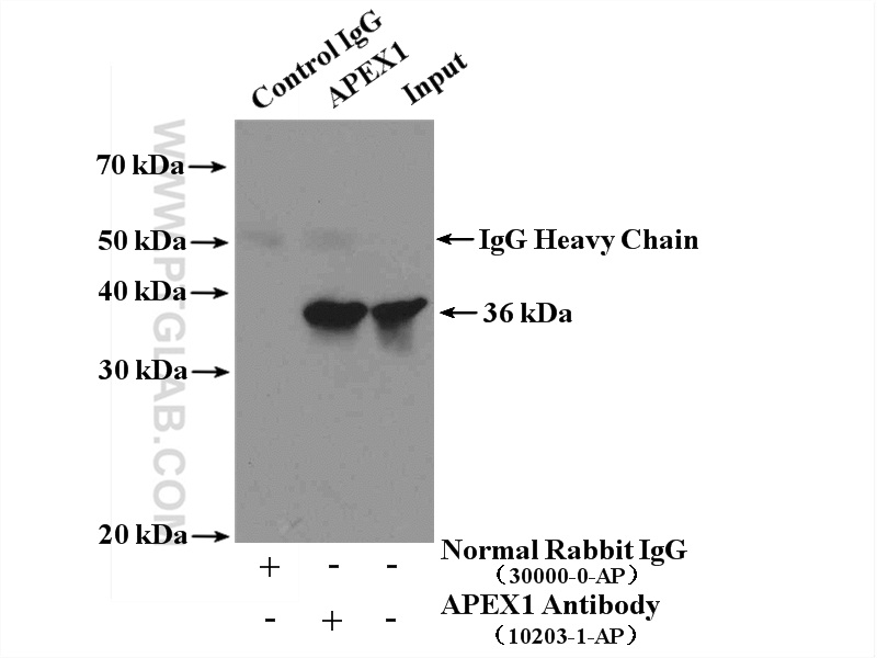 IP experiment of HeLa using 10203-1-AP