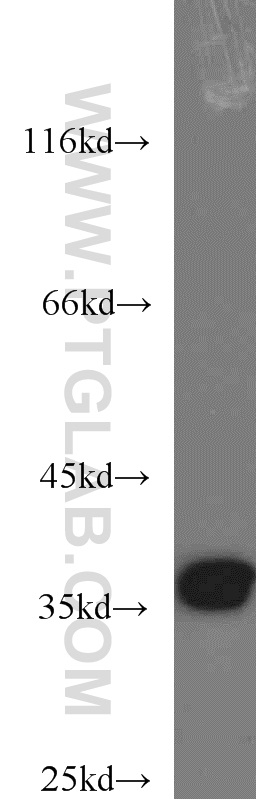 WB analysis of HeLa using 10203-1-AP