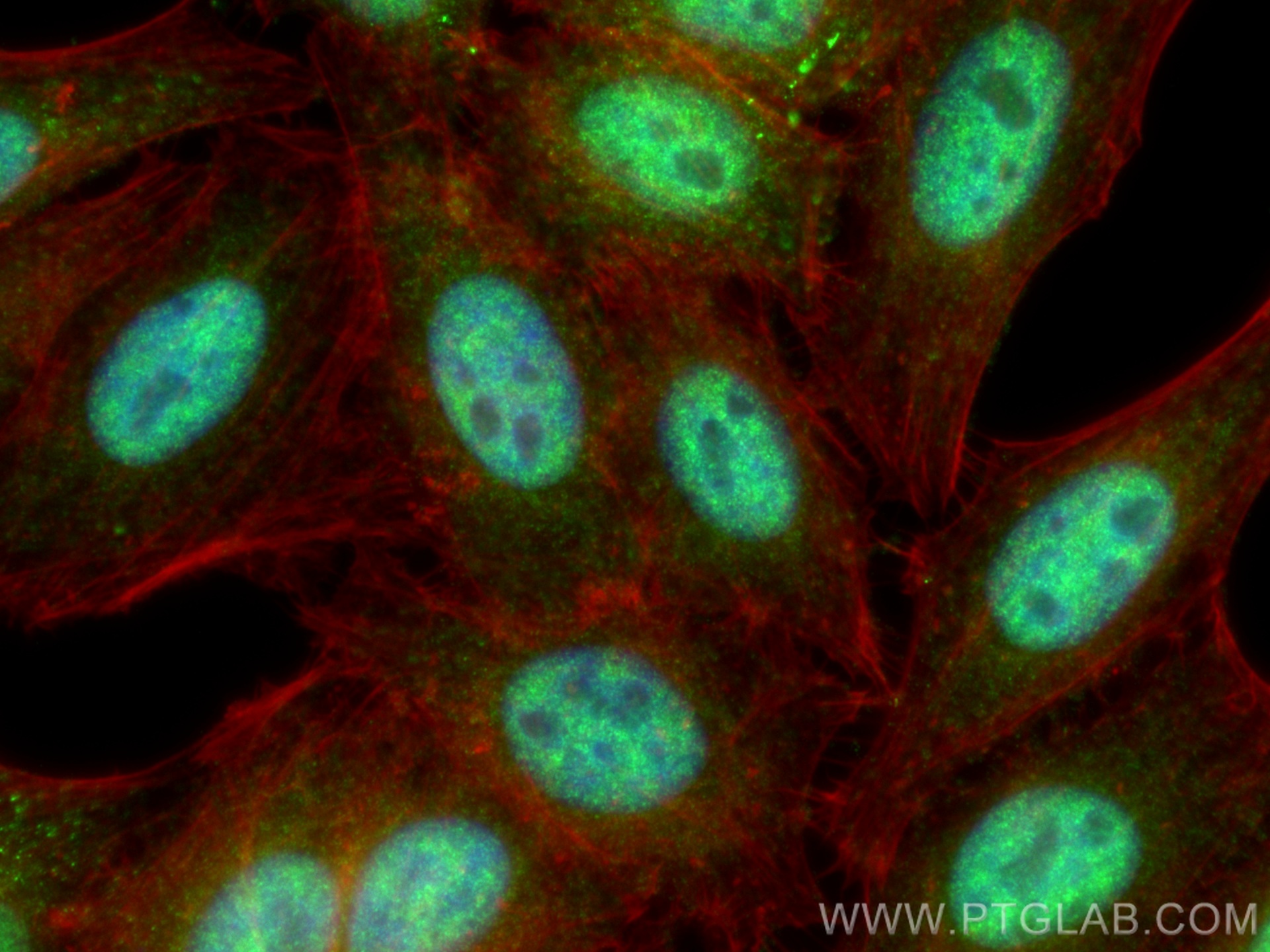 IF Staining of HepG2 using 25689-1-AP