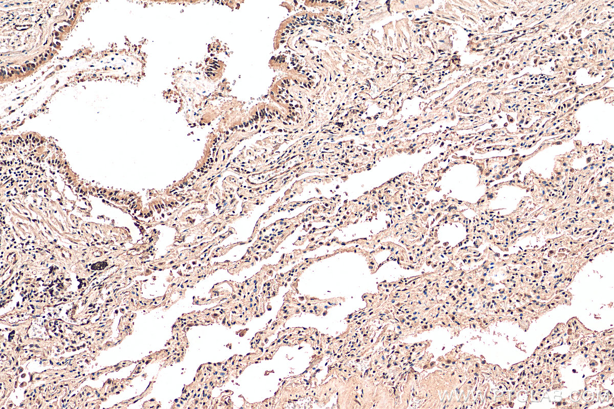 IHC staining of human lung using 25689-1-AP