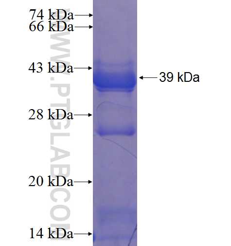 API5 fusion protein Ag22525 SDS-PAGE