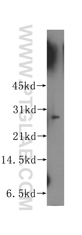 WB analysis of human kidney using 12089-2-AP