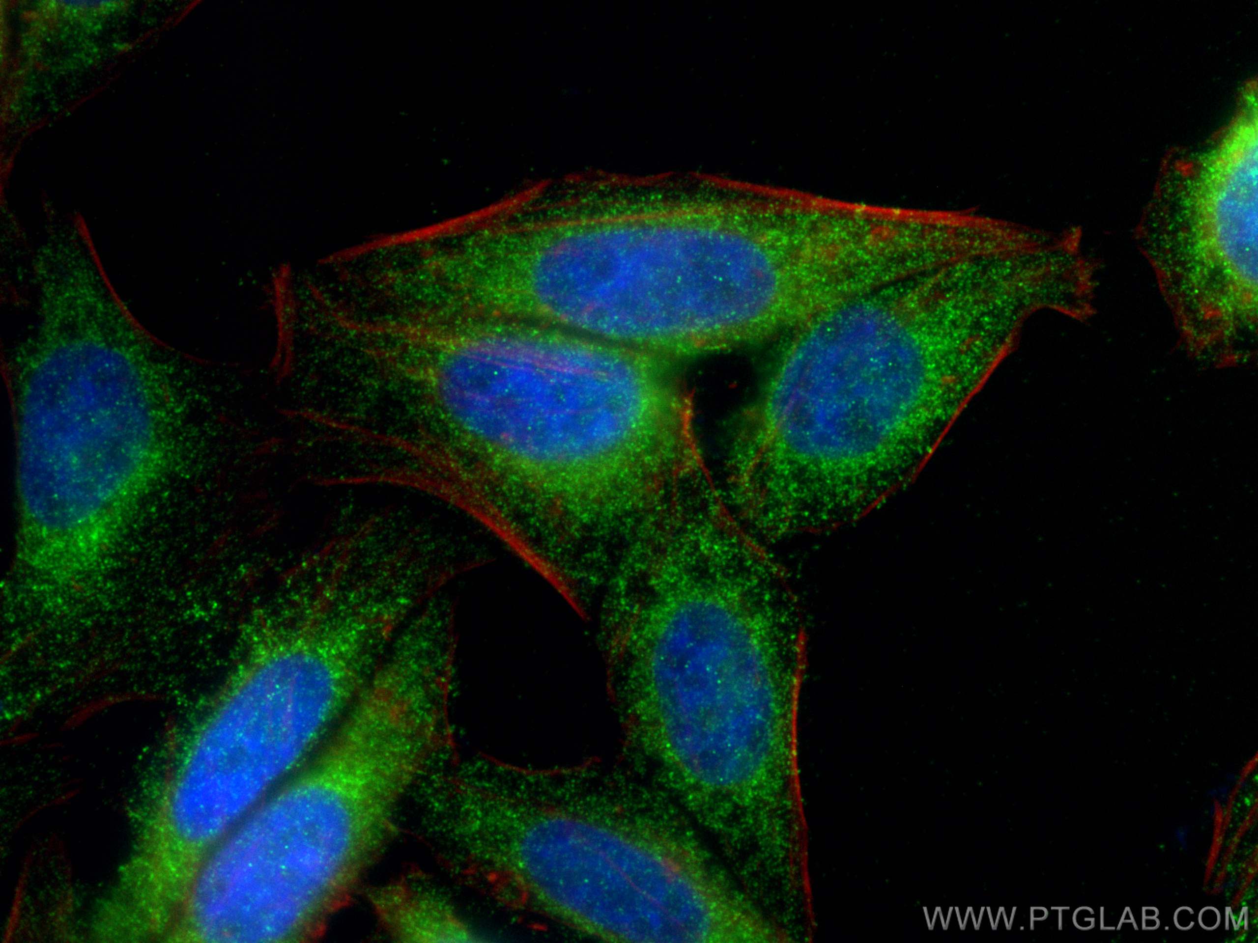 IF Staining of HepG2 using 11497-1-AP