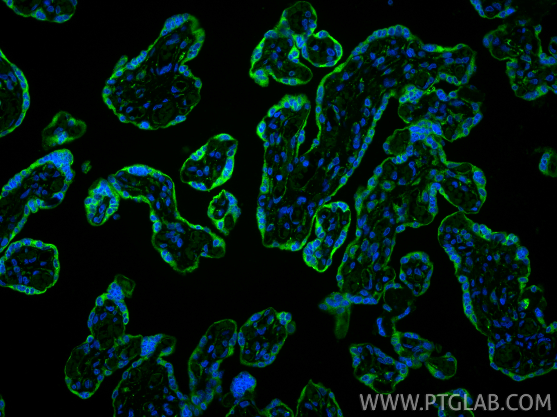 IF Staining of human placenta using 11497-1-AP