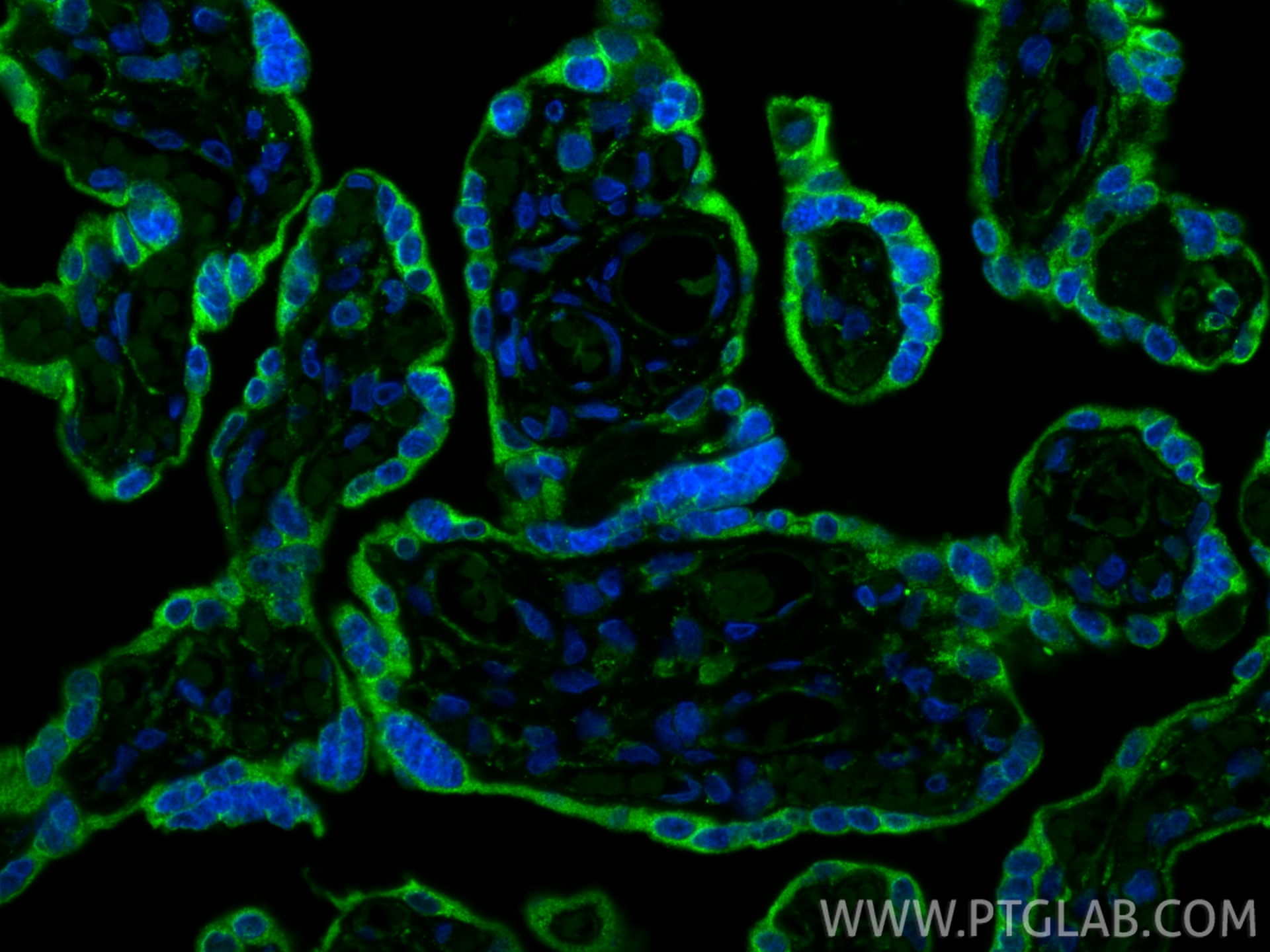 IF Staining of human placenta using 11497-1-AP