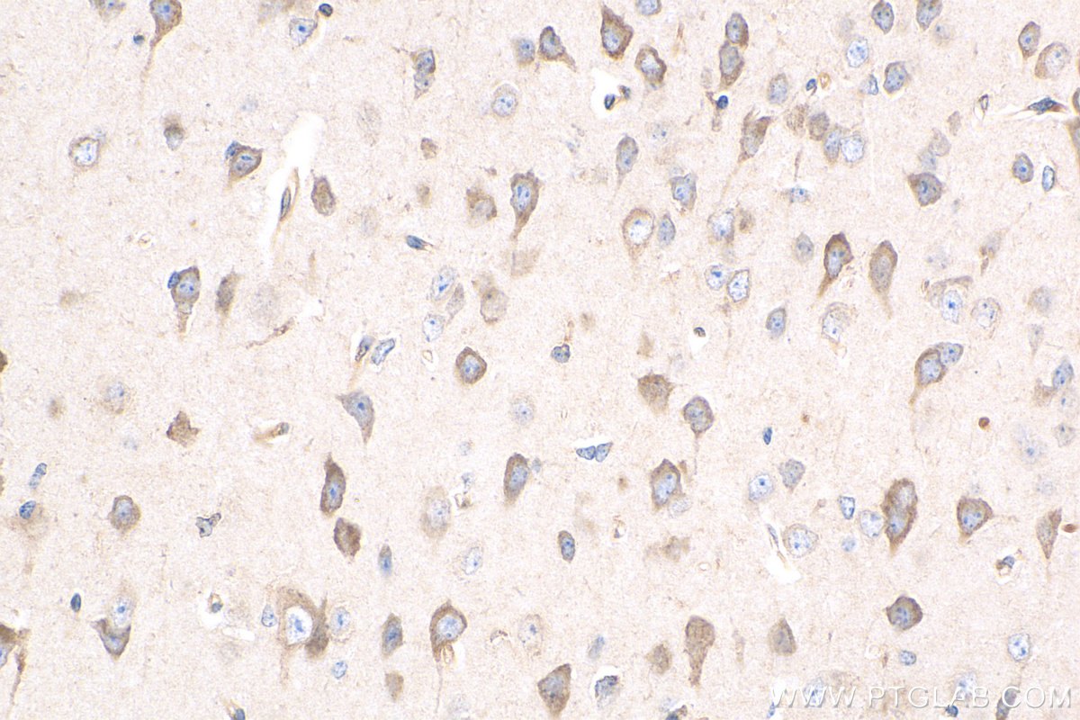 IHC staining of mouse brain using 11497-1-AP