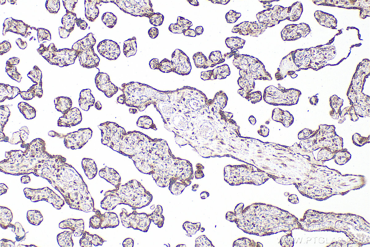 Immunohistochemical analysis of paraffin-embedded human placenta tissue slide using 11497-1-AP (Apelin antibody) at dilution of 1:200 (under 10x lens). Heat mediated antigen retrieval with Tris-EDTA buffer (pH 9.0). IHC staining of human placenta using 11497-1-AP