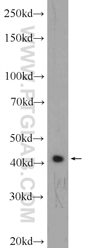 WB analysis of SH-SY5Y using 20341-1-AP