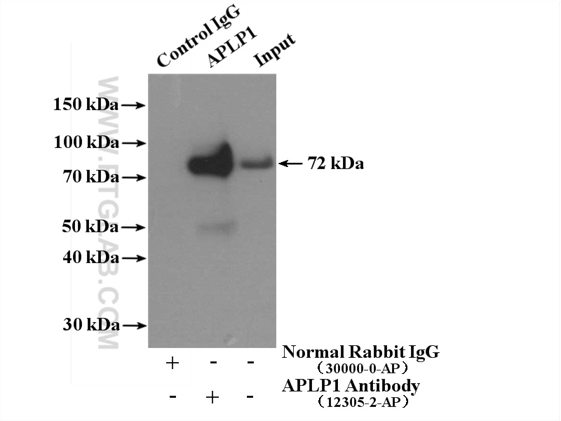 IP experiment of mouse brain using 12305-2-AP