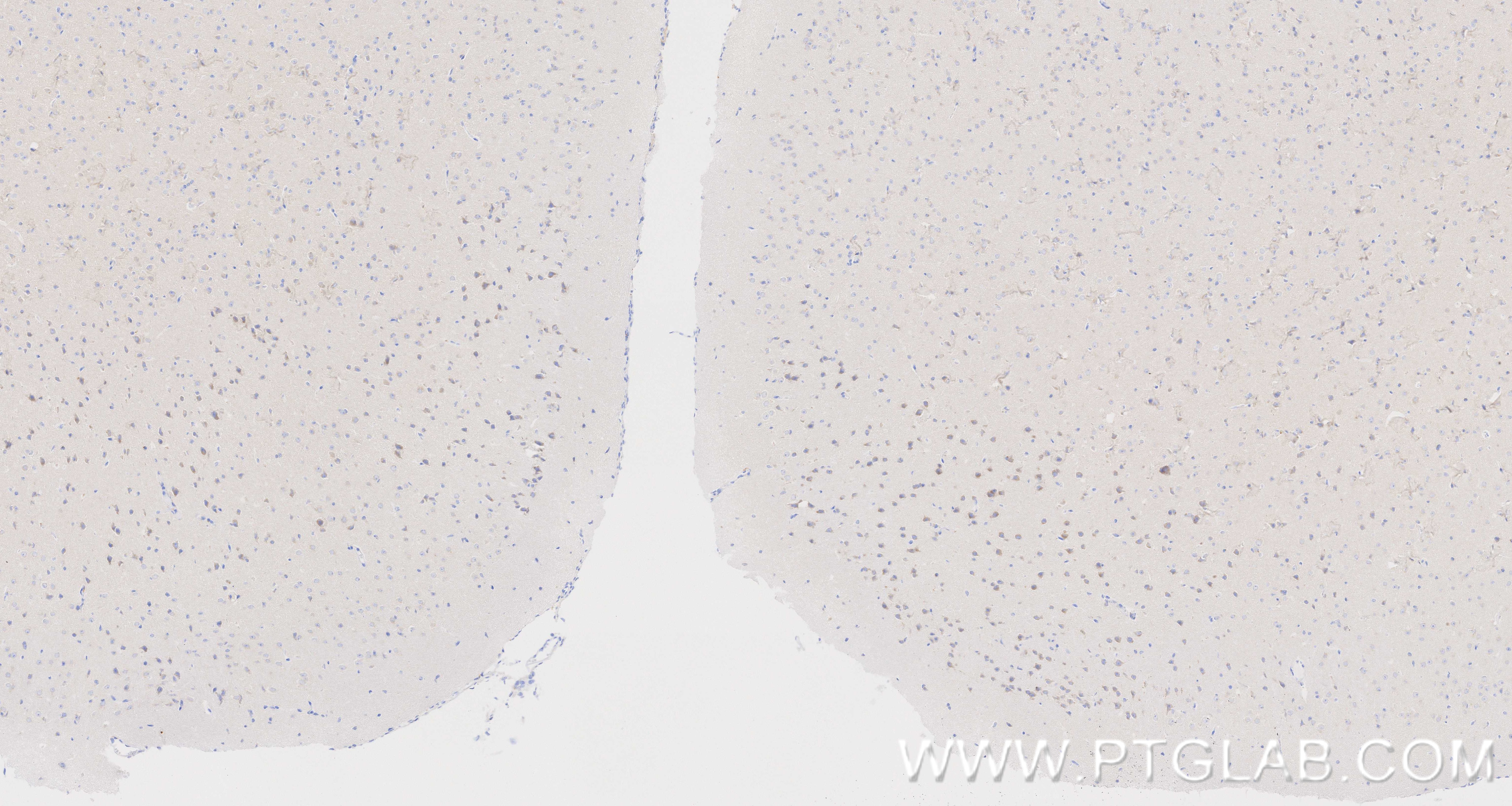 IHC staining of mouse brain using 87113-1-RR IHC staining of mouse brain using 87113-1-RR