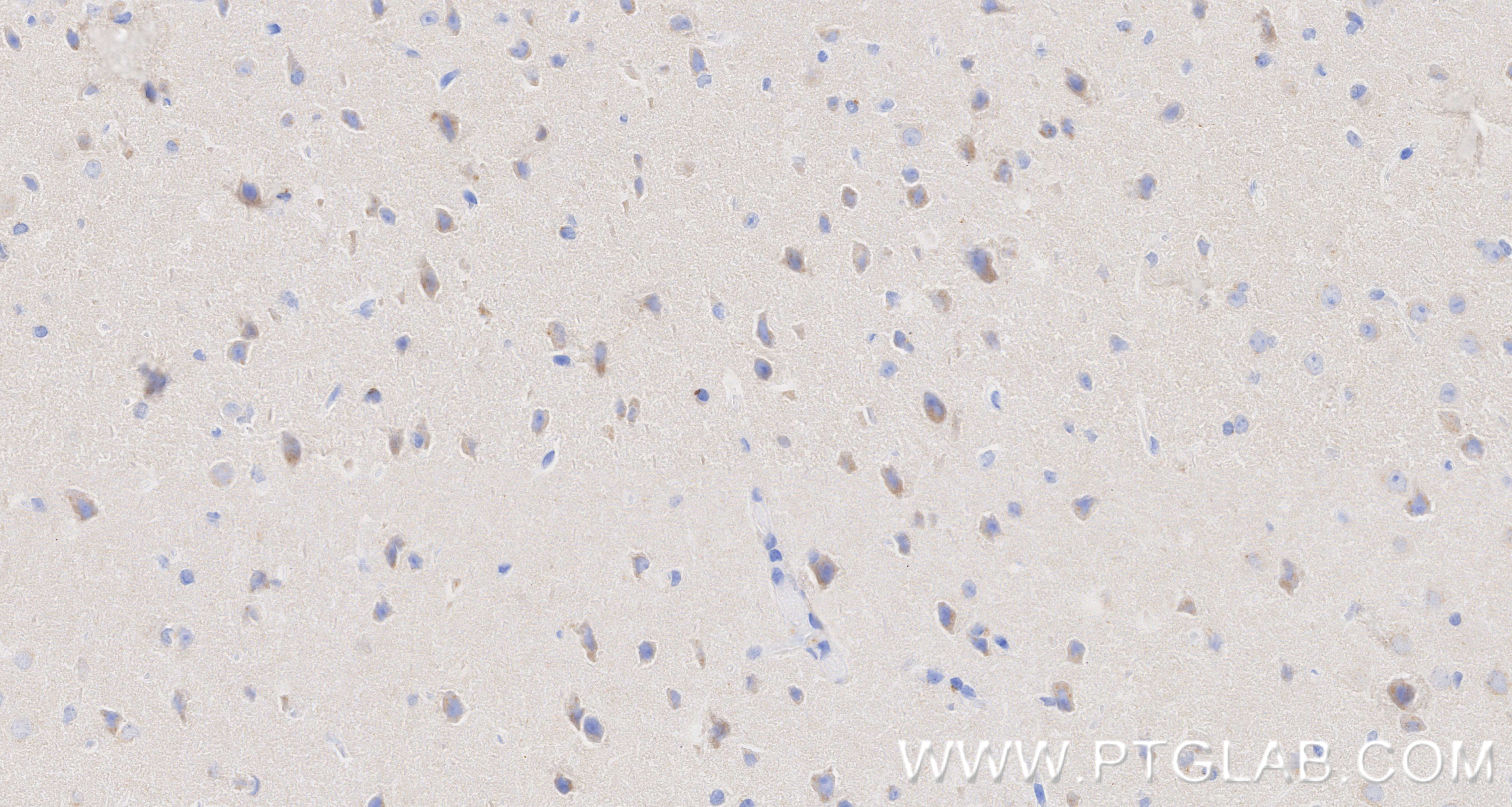 IHC staining of mouse brain using 87113-1-RR IHC staining of mouse brain using 87113-1-RR