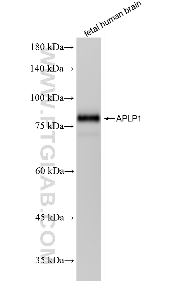 WB analysis of fetal human brain using 87113-1-RR WB analysis of fetal human brain using 87113-1-RR