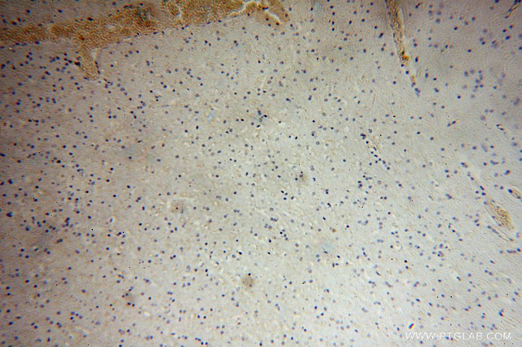 IHC staining of human brain using 15041-1-AP