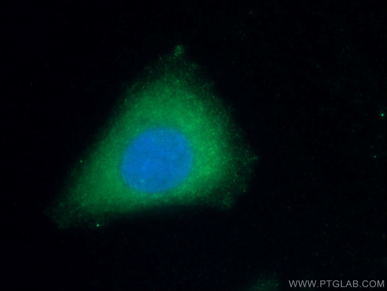 IF Staining of HepG2 using 66206-1-Ig