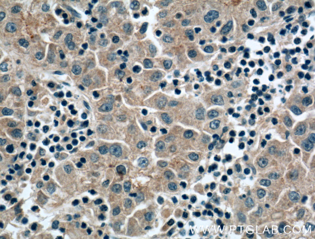 Apolipoprotein AI Monoclonal antibody