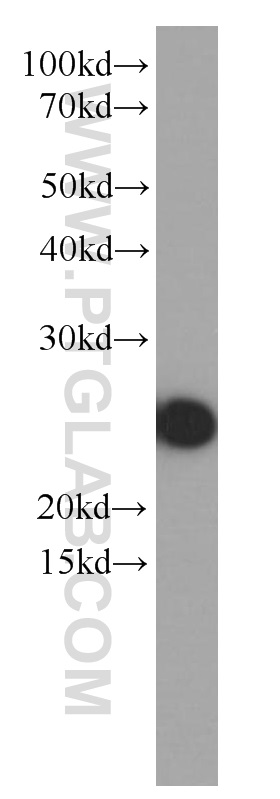 WB analysis of human plasma using 66206-1-Ig