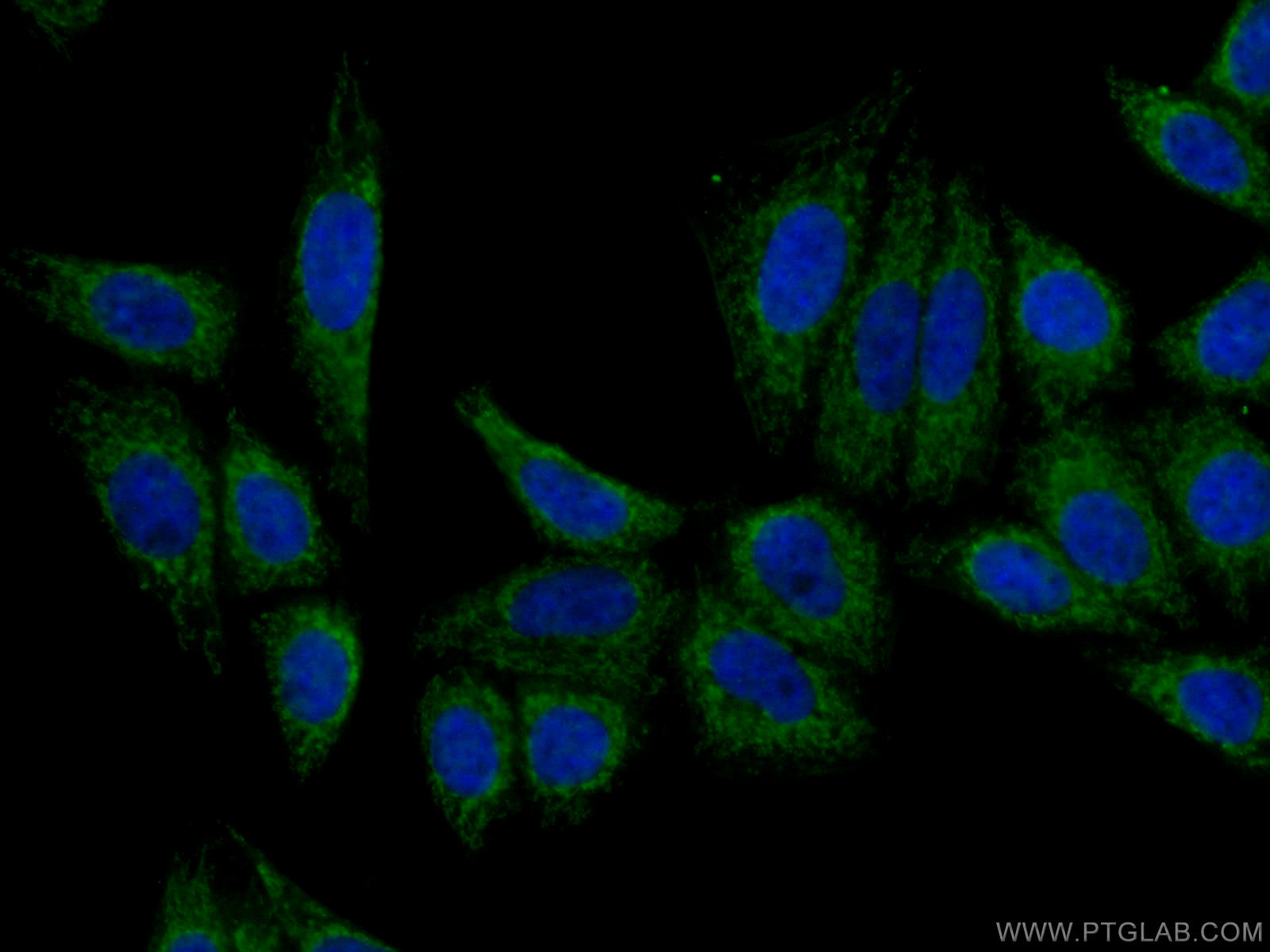 IF Staining of HepG2 using 16845-1-AP