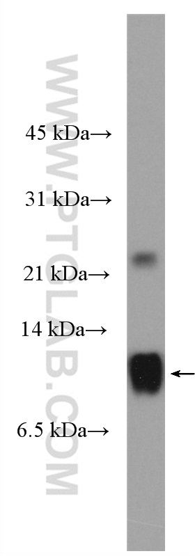 WB analysis of human plasma using 16845-1-AP