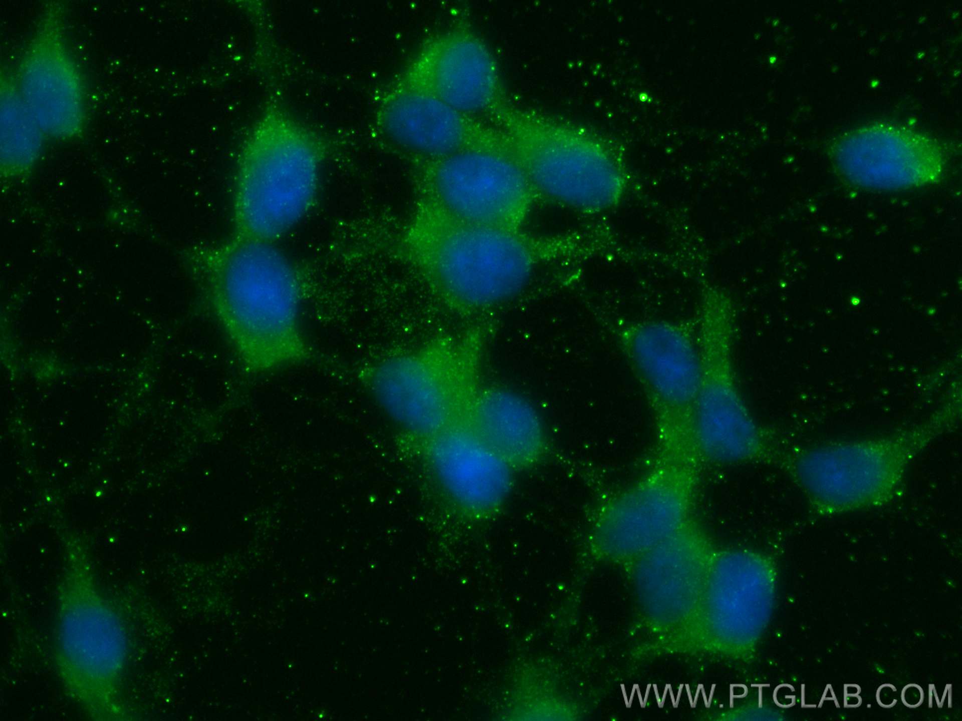 IF Staining of SH-SY5Y using 66252-1-Ig