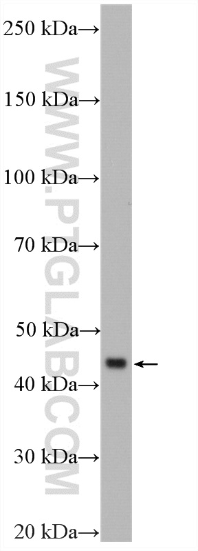 APOA5