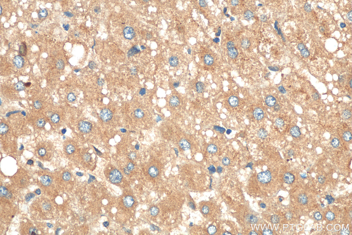 IHC staining of human liver using 20578-1-AP