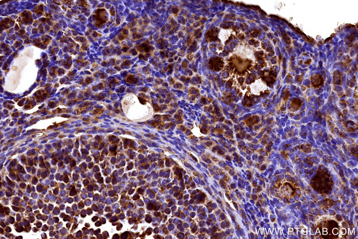 IHC staining of mouse ovary using 27751-1-AP IHC staining of mouse ovary using 27751-1-AP