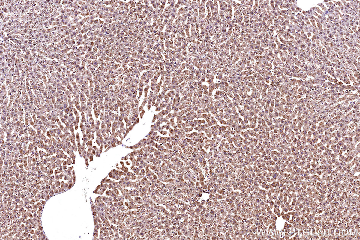 IHC staining of rat liver using 27751-1-AP IHC staining of rat liver using 27751-1-AP