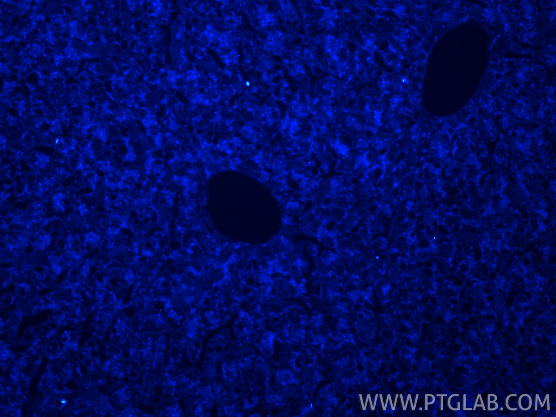 IF Staining of mouse liver using CL405-84047