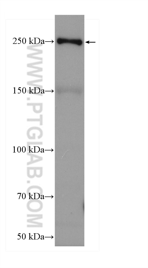 WB analysis of mouse liver using HRP-20578