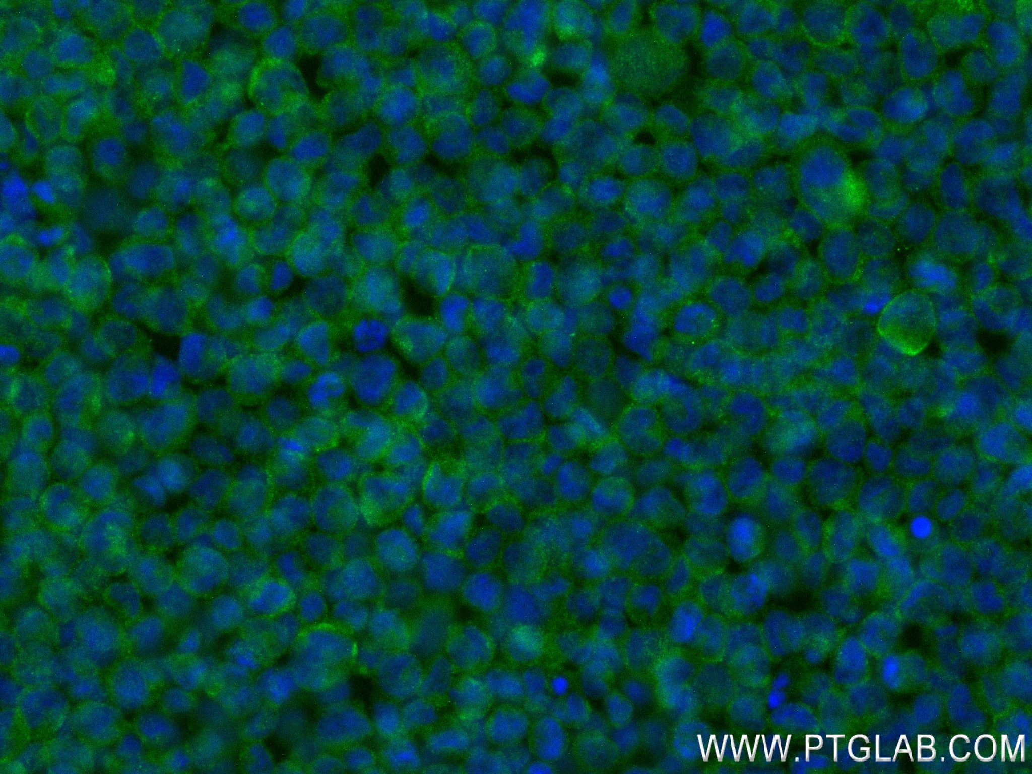 IF Staining of THP-1 using 84239-2-RR (same clone as 84239-2-PBS)