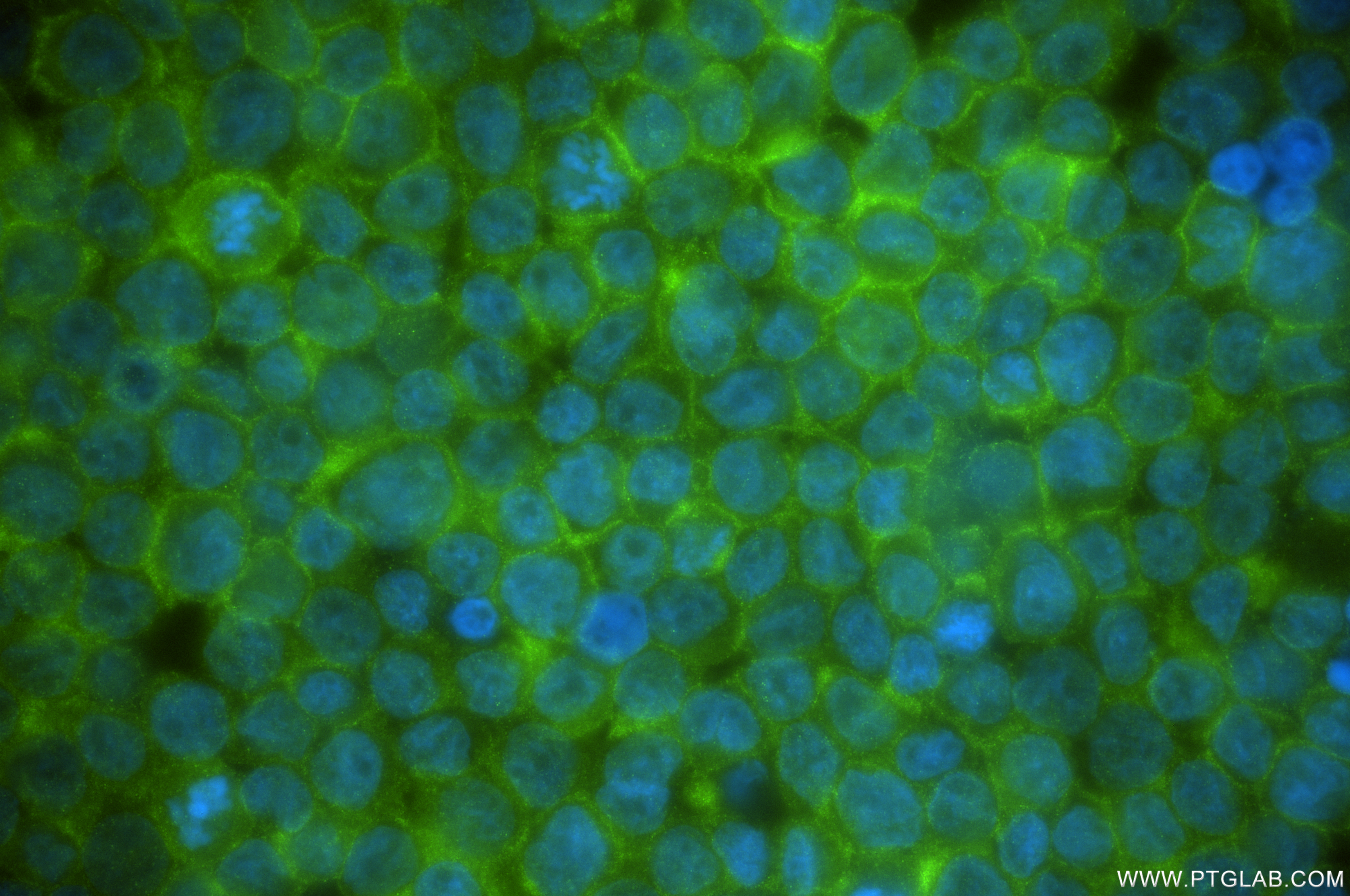 IF Staining of THP-1 using 84239-4-RR (same clone as 84239-4-PBS)