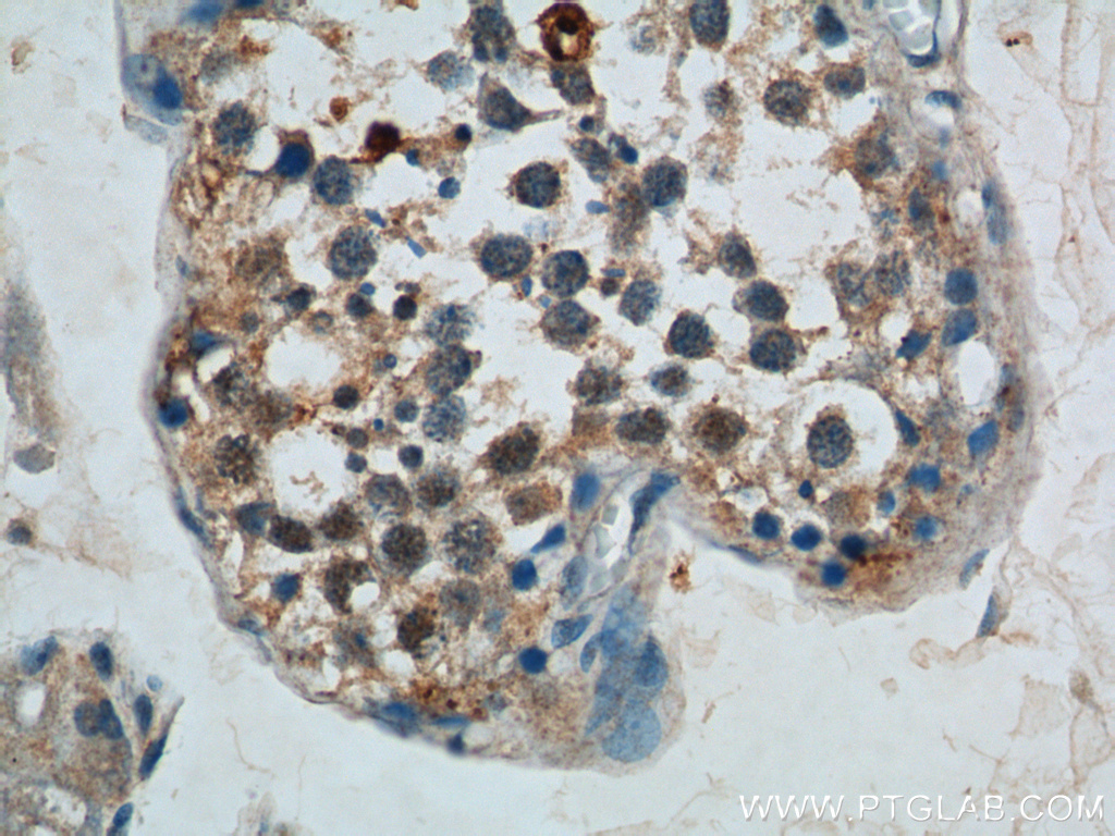 IHC staining of human testis using 10608-1-AP