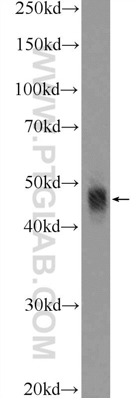 WB analysis of mouse colon using 10608-1-AP