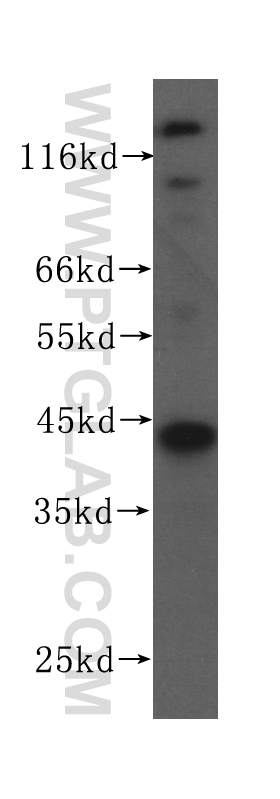 WB analysis of A375 using 60100-1-Ig