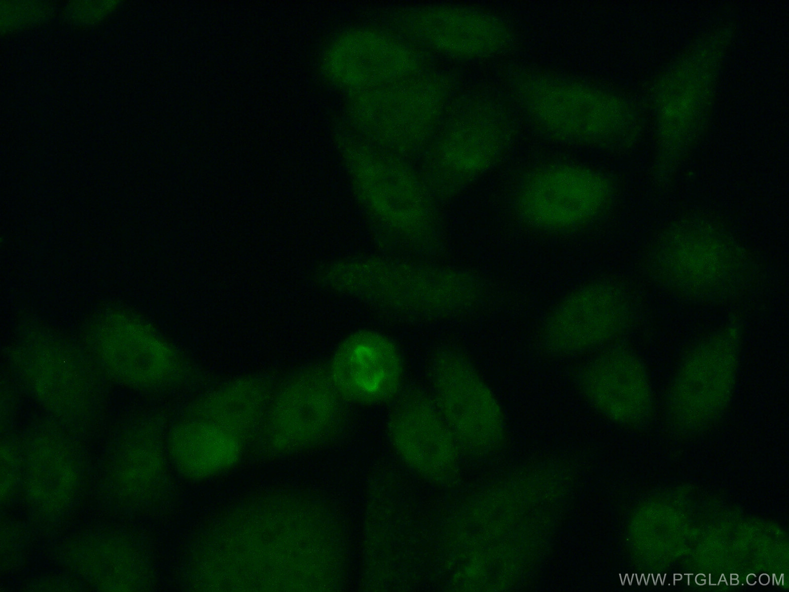 IF Staining of HeLa using 17166-1-AP