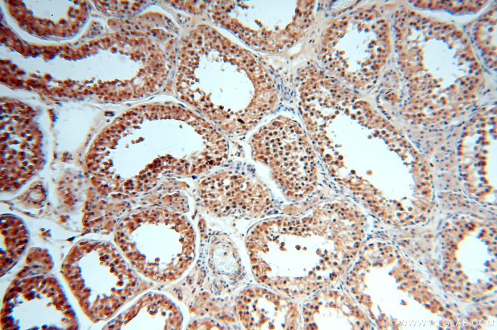 IHC staining of human testis using 17166-1-AP