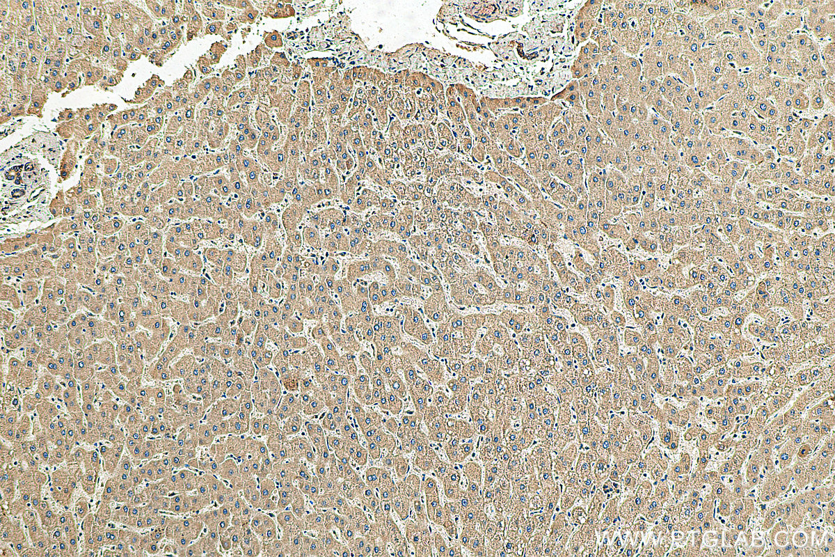 IHC staining of human liver using 22262-1-AP