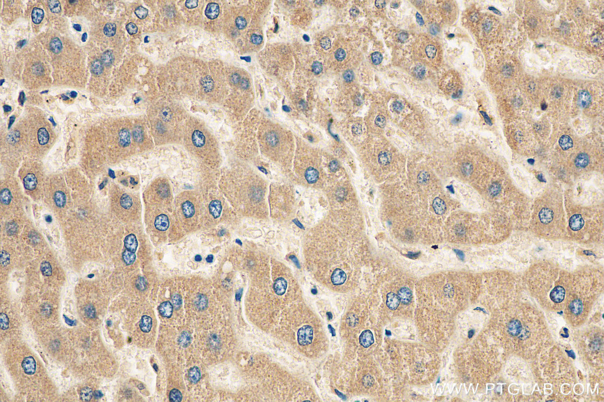 IHC staining of human liver using 22262-1-AP