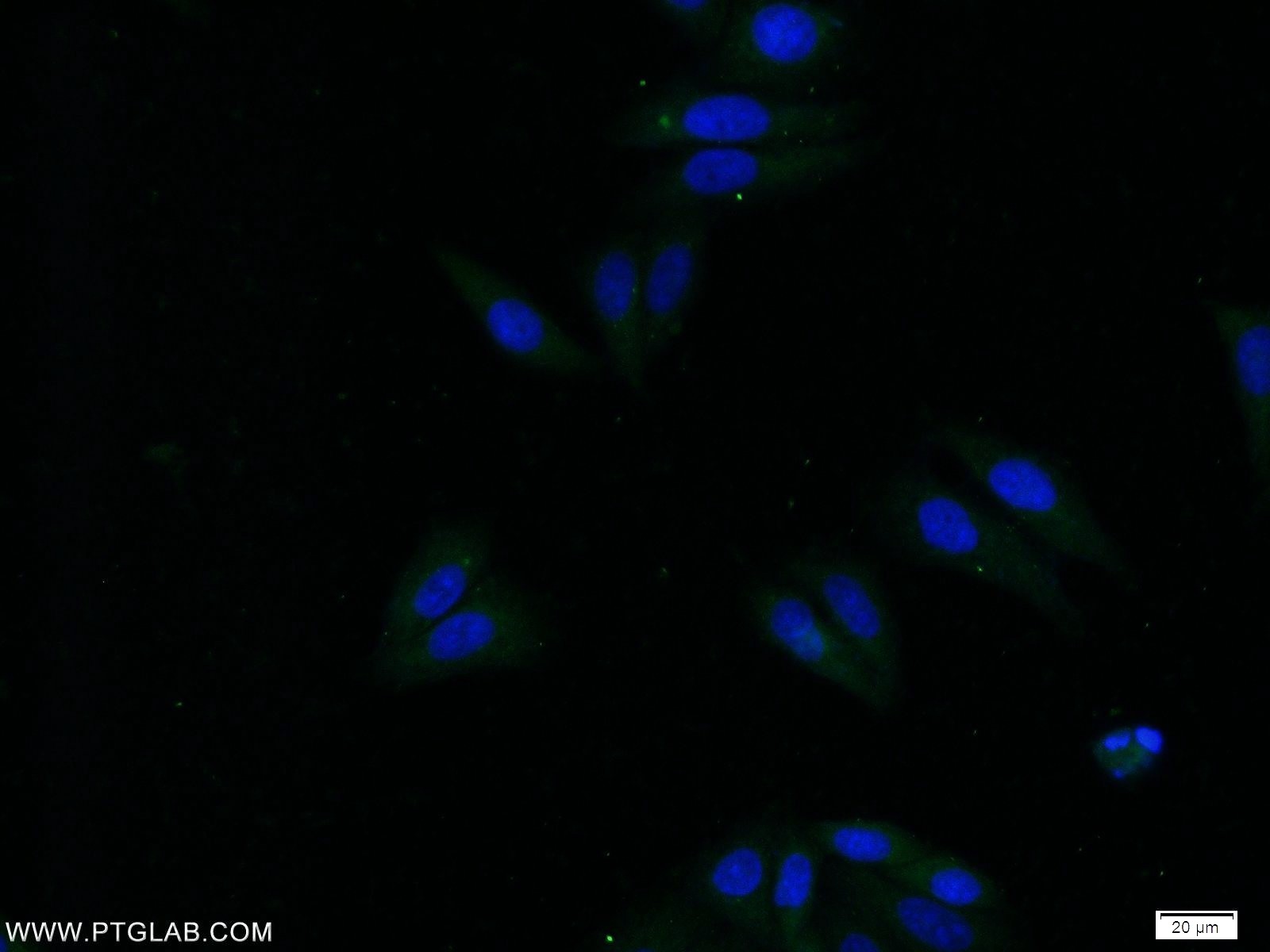 IF Staining of HepG2 using 16530-1-AP