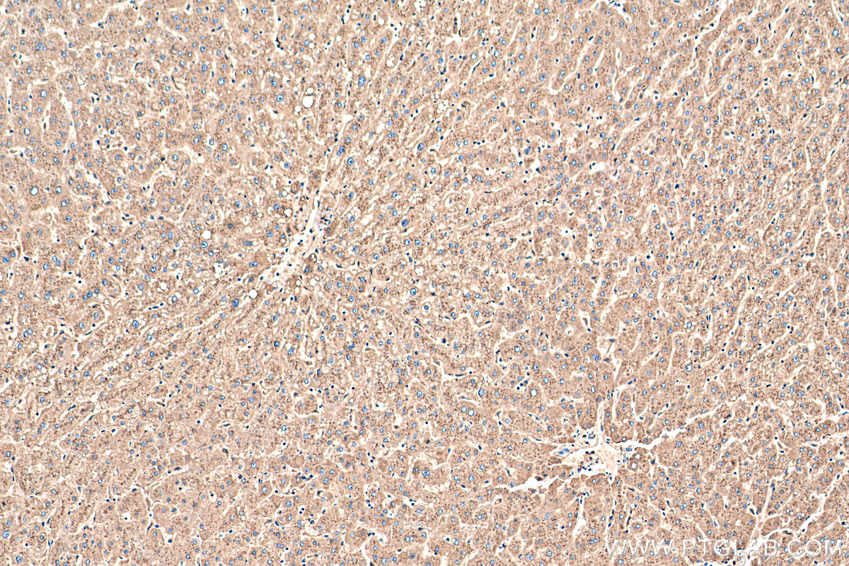 IHC staining of human liver using 10520-1-AP