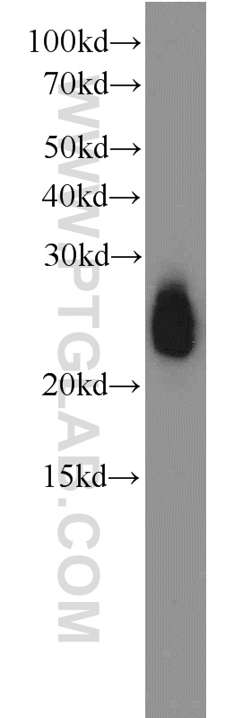 WB analysis of human plasma using 10520-1-AP